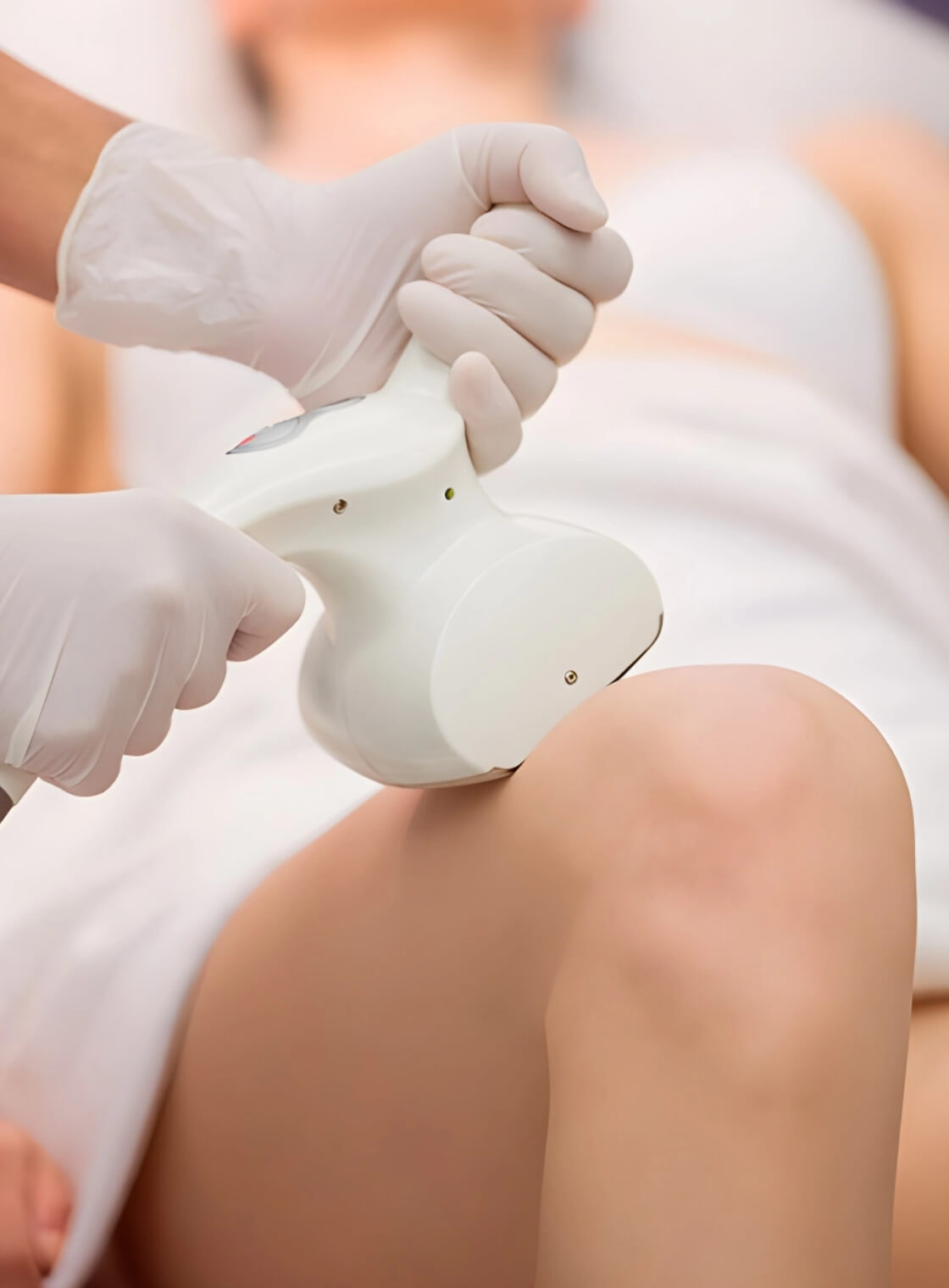 Laser Hair Removal