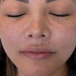 B&A