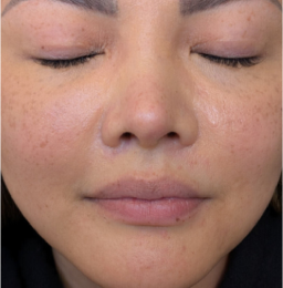 B&A