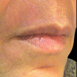 B&A